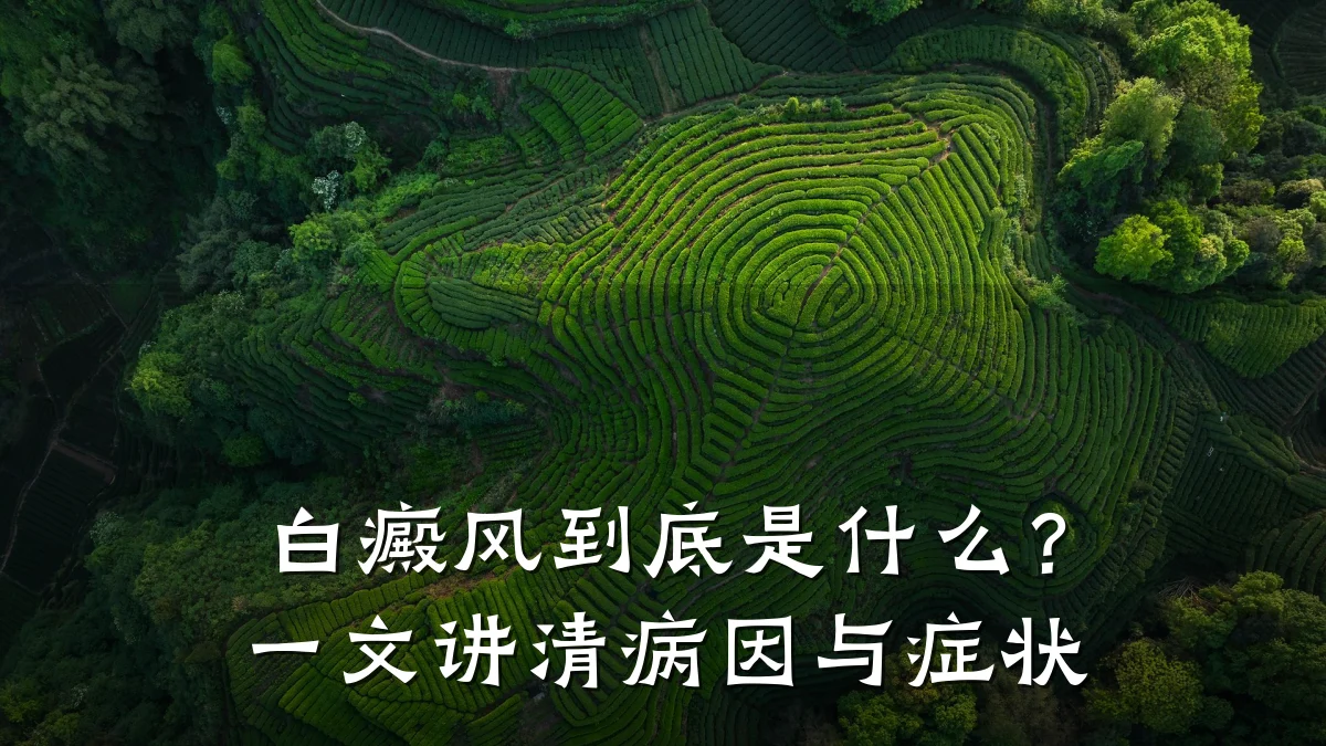 白癜风到底是什么?一文讲清病因与症状