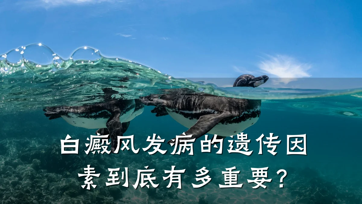 白癜风发病的遗传因素到底有多重要?