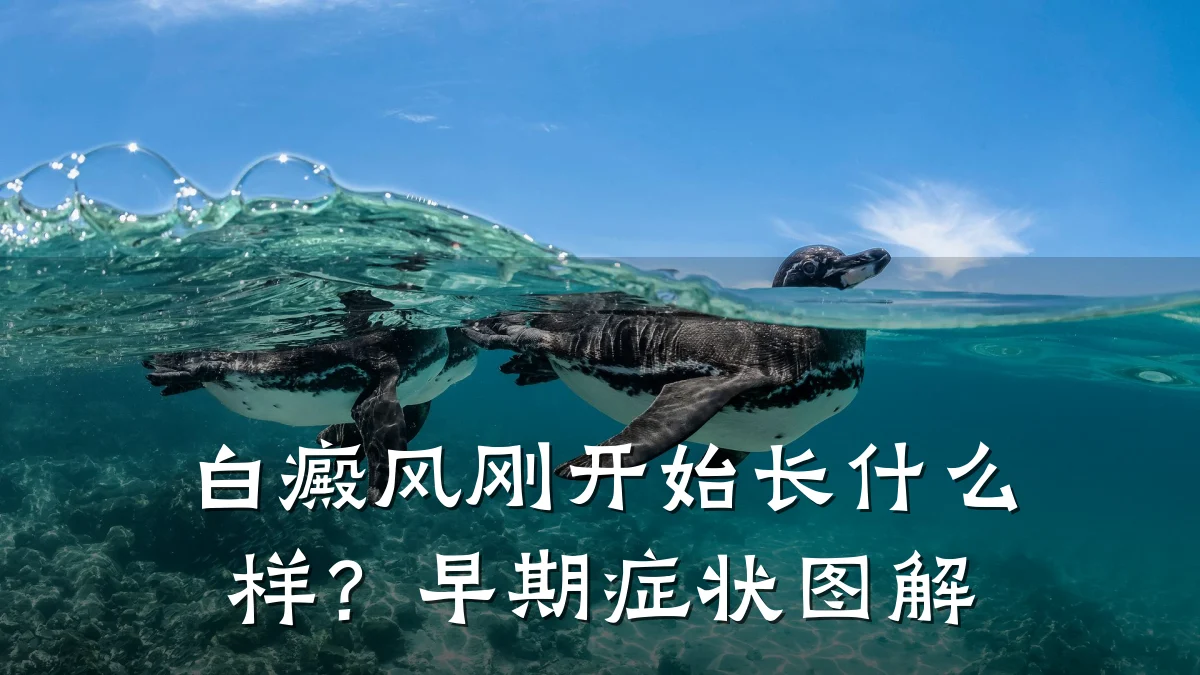 白癜风刚开始长什么样?早期症状图解