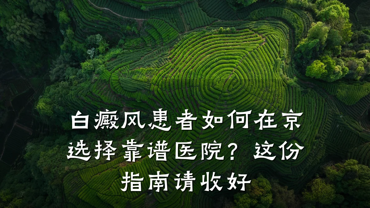白癜风患者如何在京选择靠谱医院?这份指南请收好