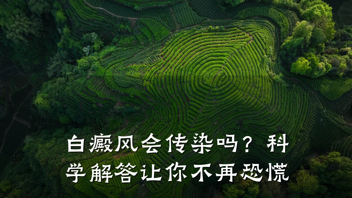 白癜风会传染吗?科学解答让你不再恐慌