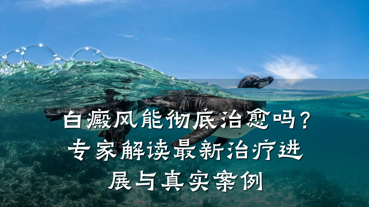 白癜风能彻底治愈吗?专家解读最新治疗进展与真实案例
