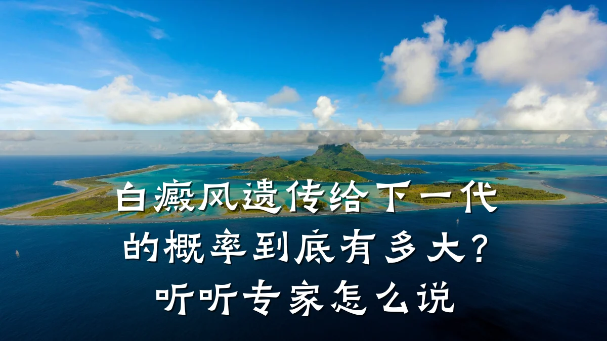 白癜风遗传给下一代的概率到底有多大?听听专家怎么说