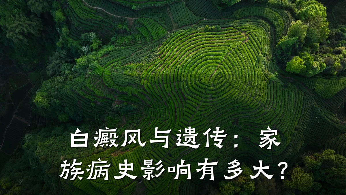 白癜风与遗传:家族病史影响有多大?