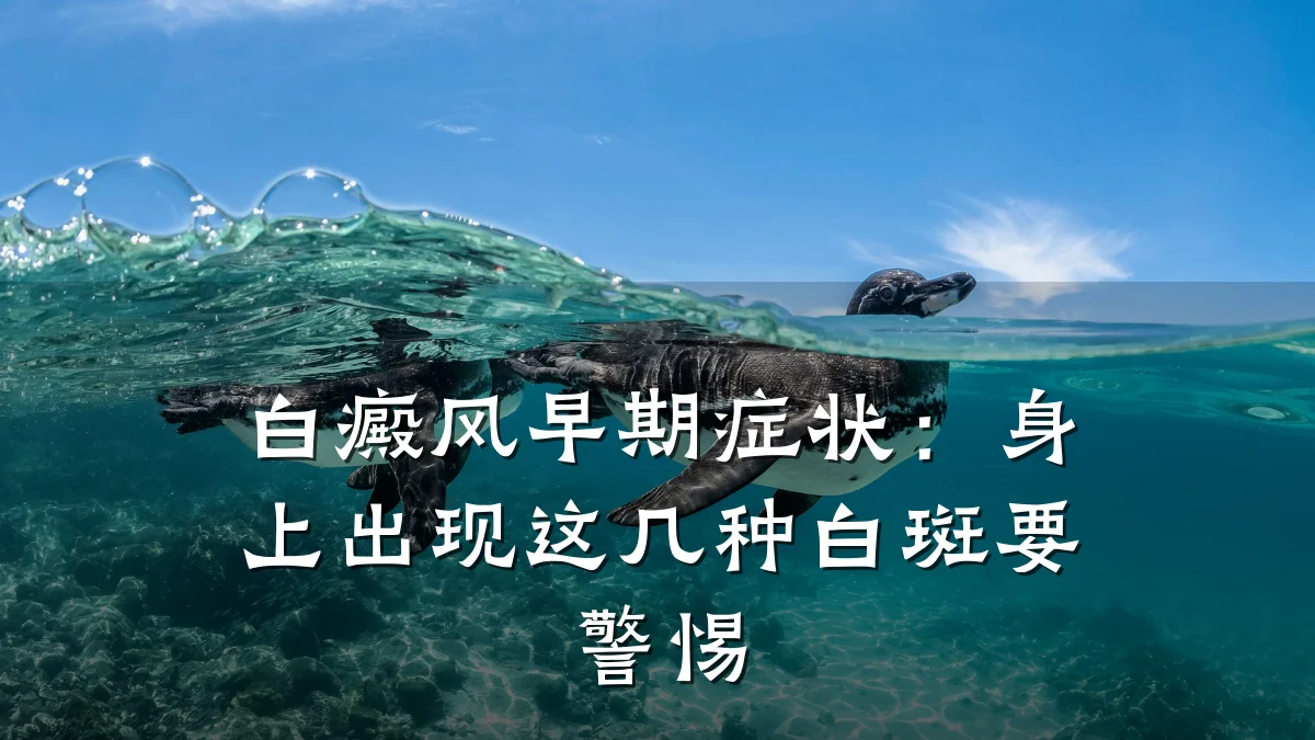 白癜风早期症状:身上出现这几种白斑要警惕