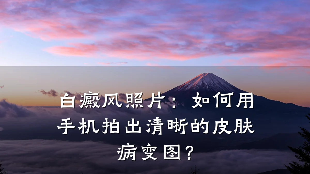 白癜风照片:如何用手机拍出清晰的皮肤病变图?