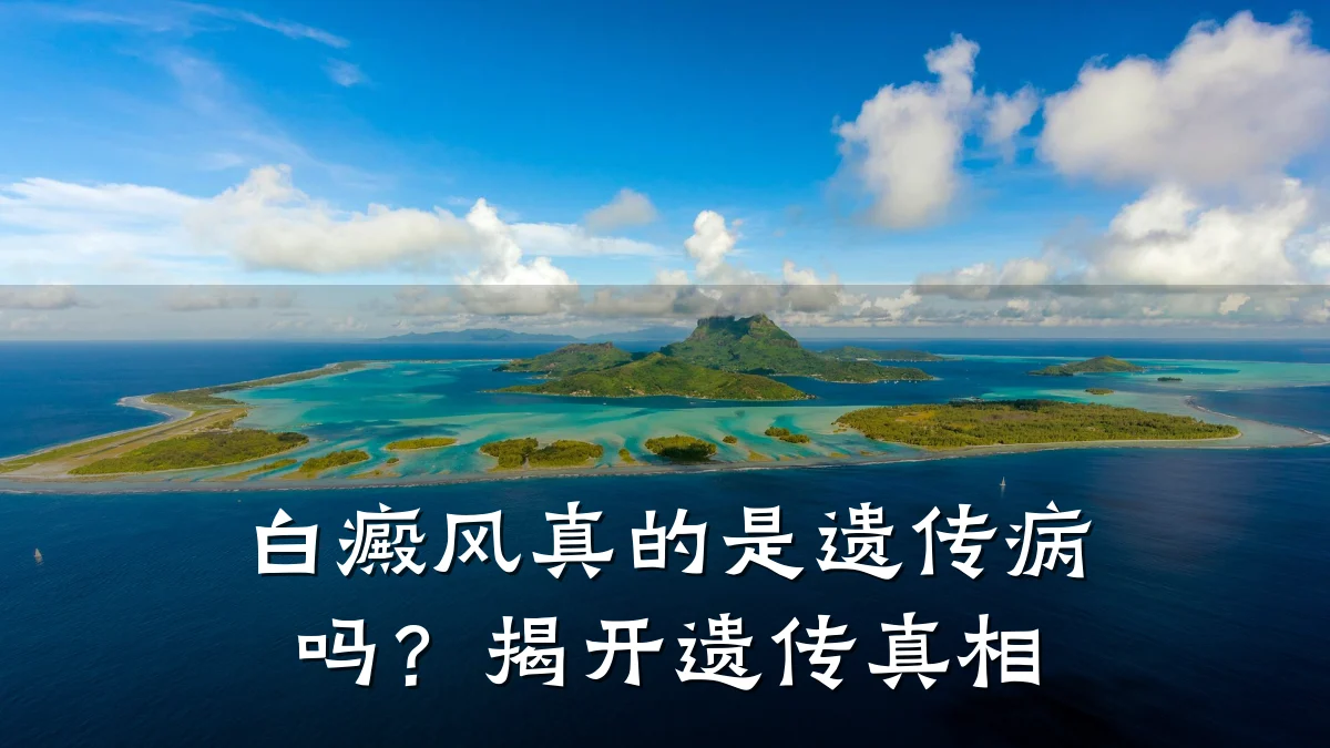 白癜风真的是遗传病吗?揭开遗传真相
