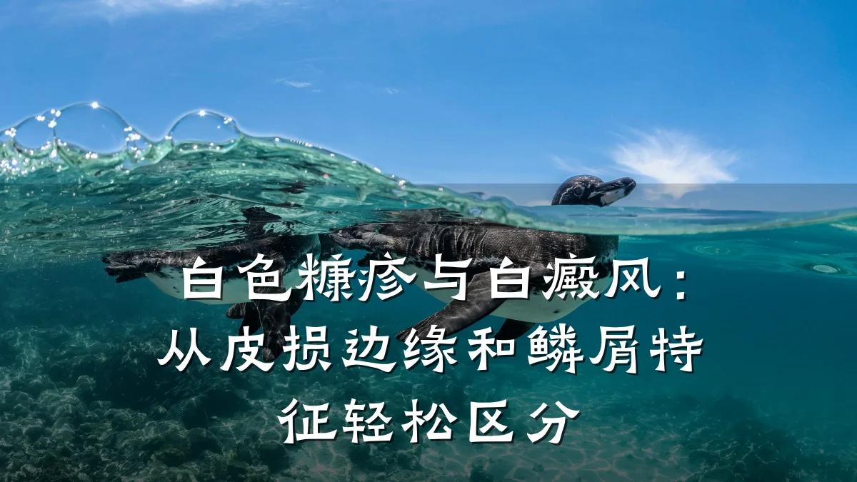 白色糠疹与白癜风:从皮损边缘和鳞屑特征轻松区分