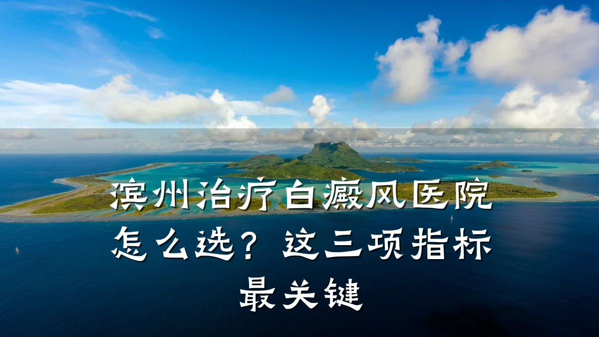 滨州治疗白癜风医院怎么选?这三项指标最关键