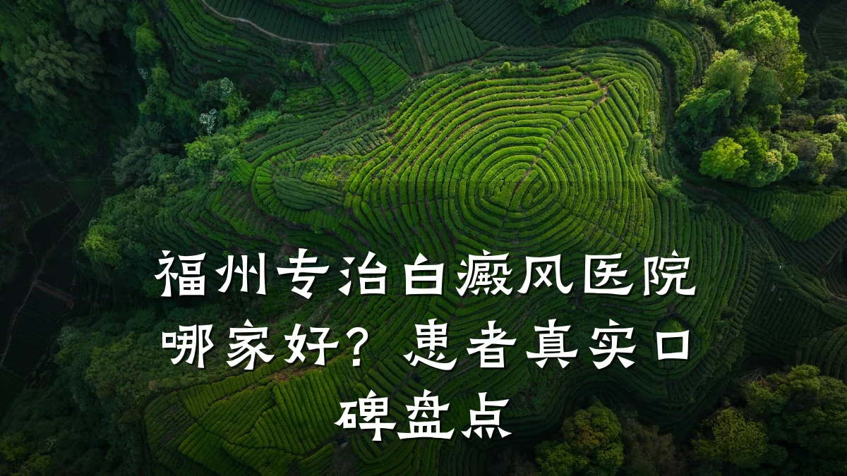 福州专治白癜风医院哪家好?患者真实口碑盘点