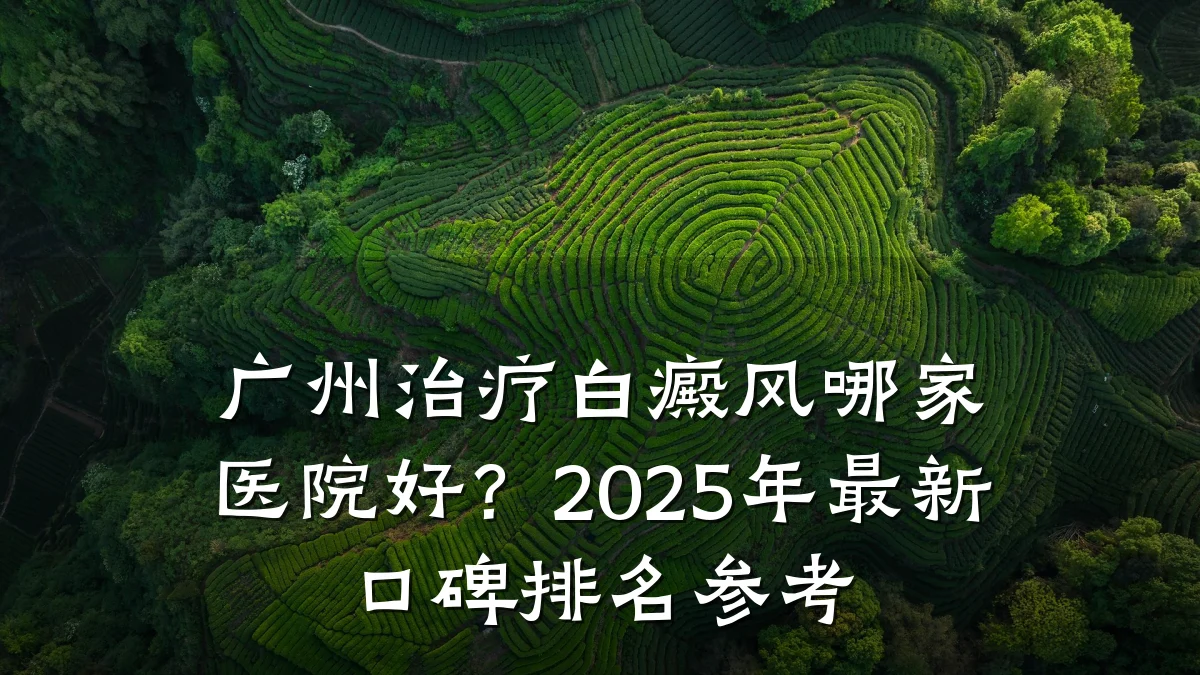 广州治疗白癜风哪家医院好？2025年最新口碑排名参考