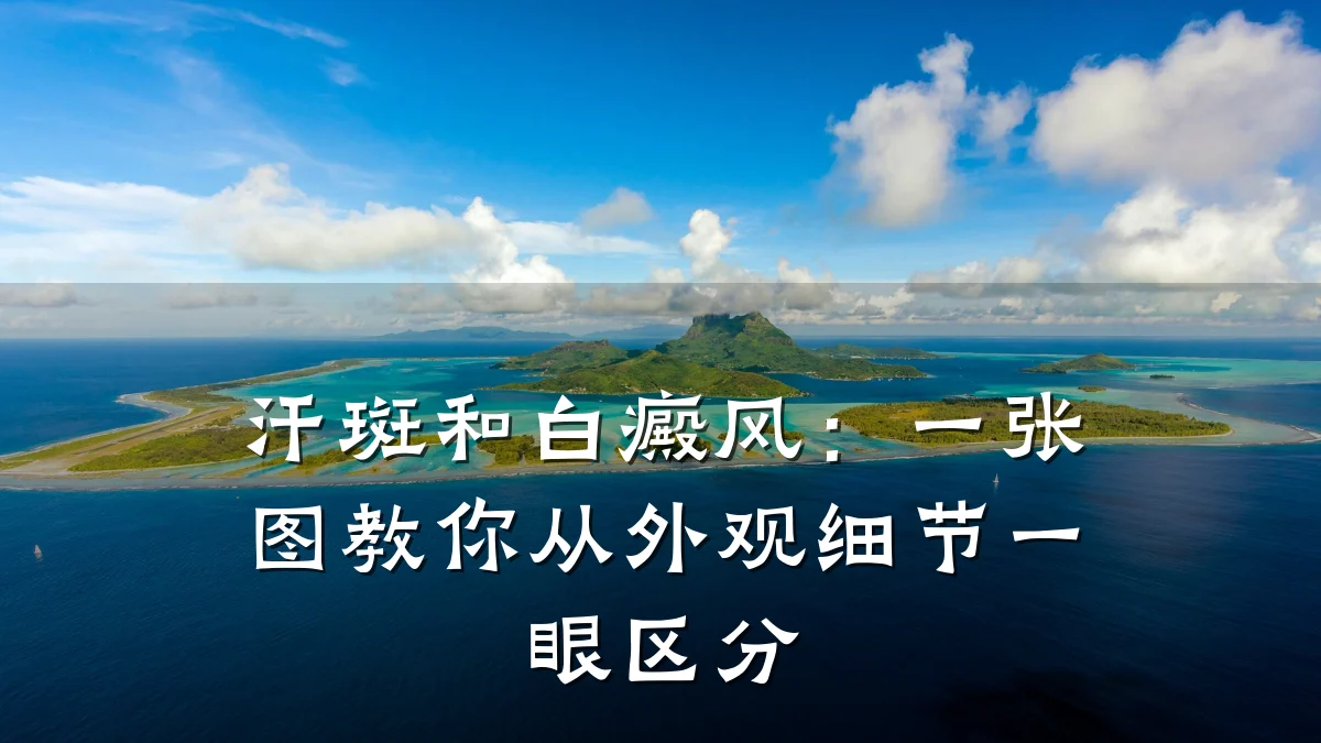 汗斑和白癜风:一张图教你从外观细节一眼区分