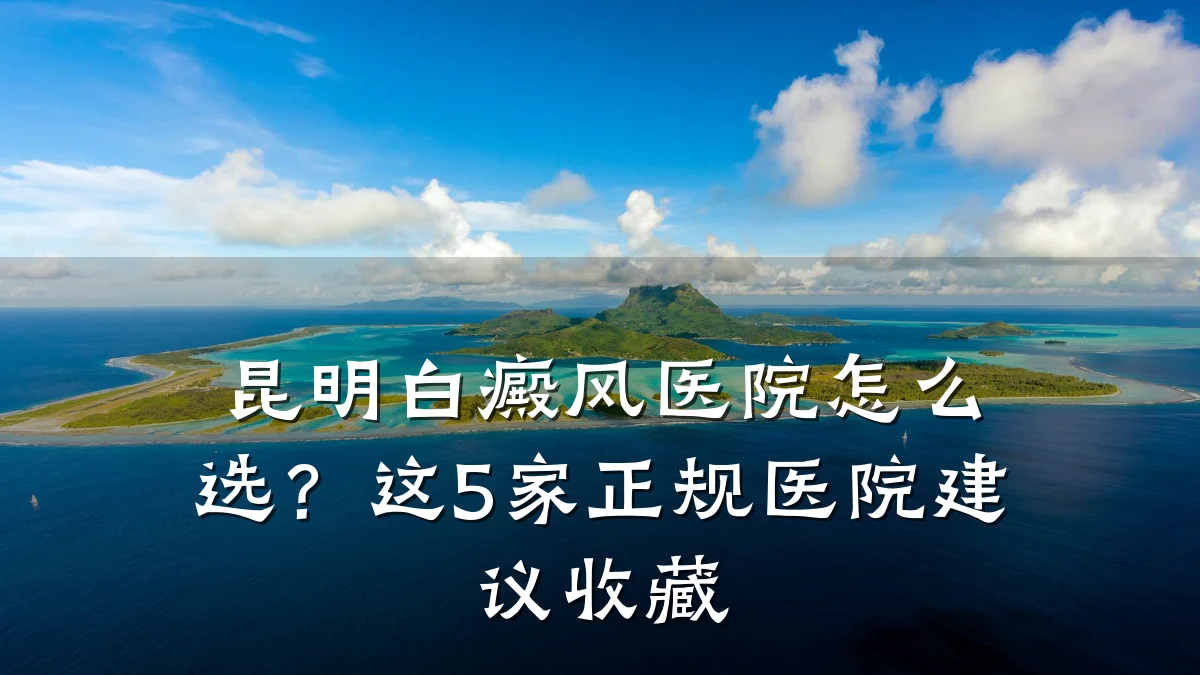 昆明白癜风医院怎么选？这5家正规医院建议收藏