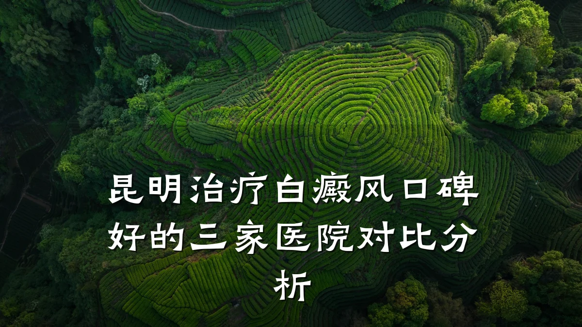 昆明治疗白癜风口碑好的三家医院对比分析