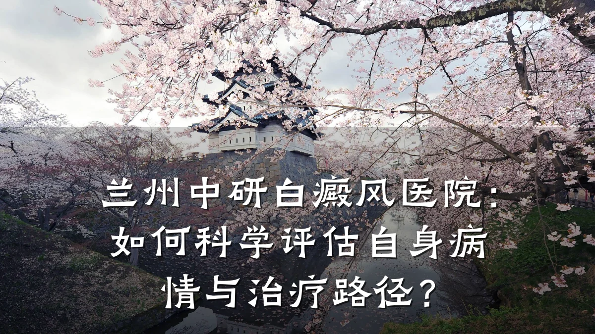 兰州中研白癜风医院:如何科学评估自身病情与治疗路径?