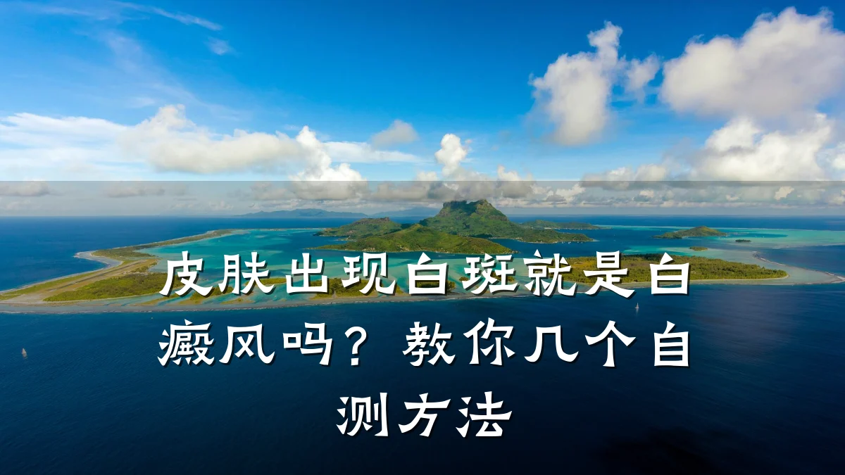 皮肤出现白斑就是白癜风吗?教你几个自测方法