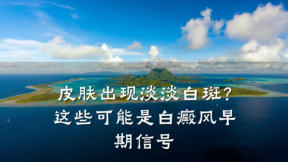皮肤出现淡淡白斑?这些可能是白癜风早期信号