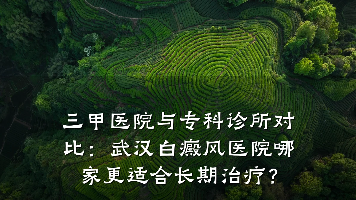 三甲医院与专科诊所对比:武汉白癜风医院哪家更适合长期治疗?