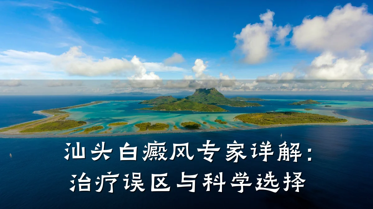 汕头白癜风专家详解:治疗误区与科学选择