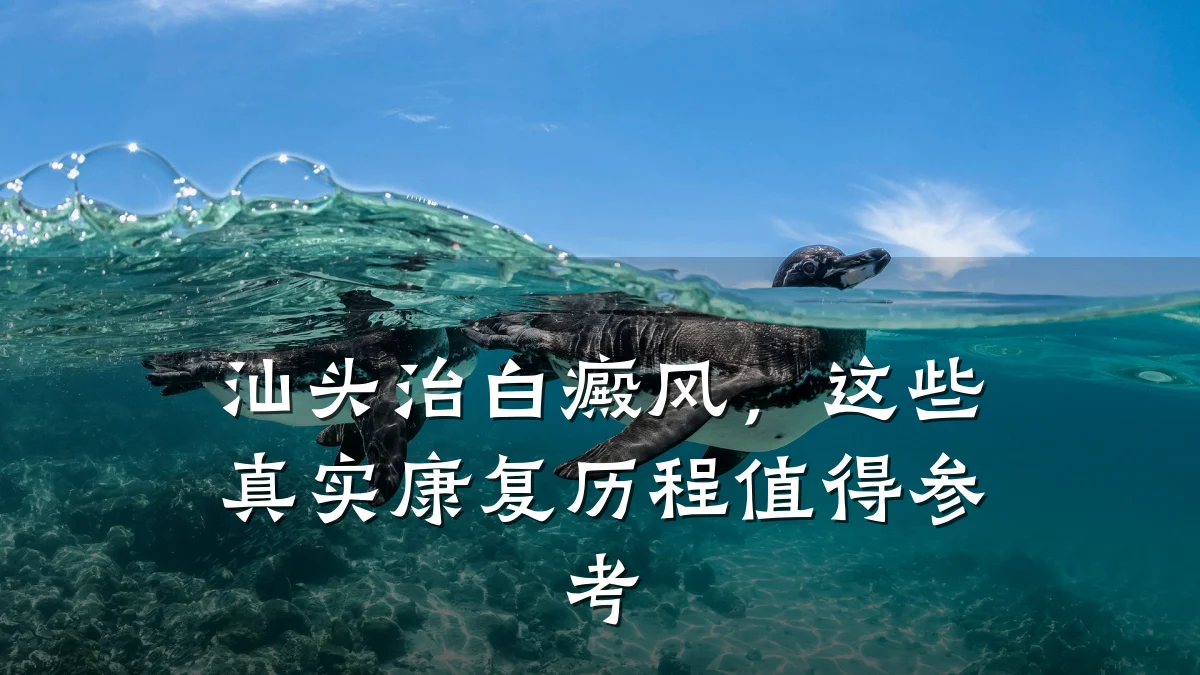 汕头治白癜风,这些真实康复历程值得参考