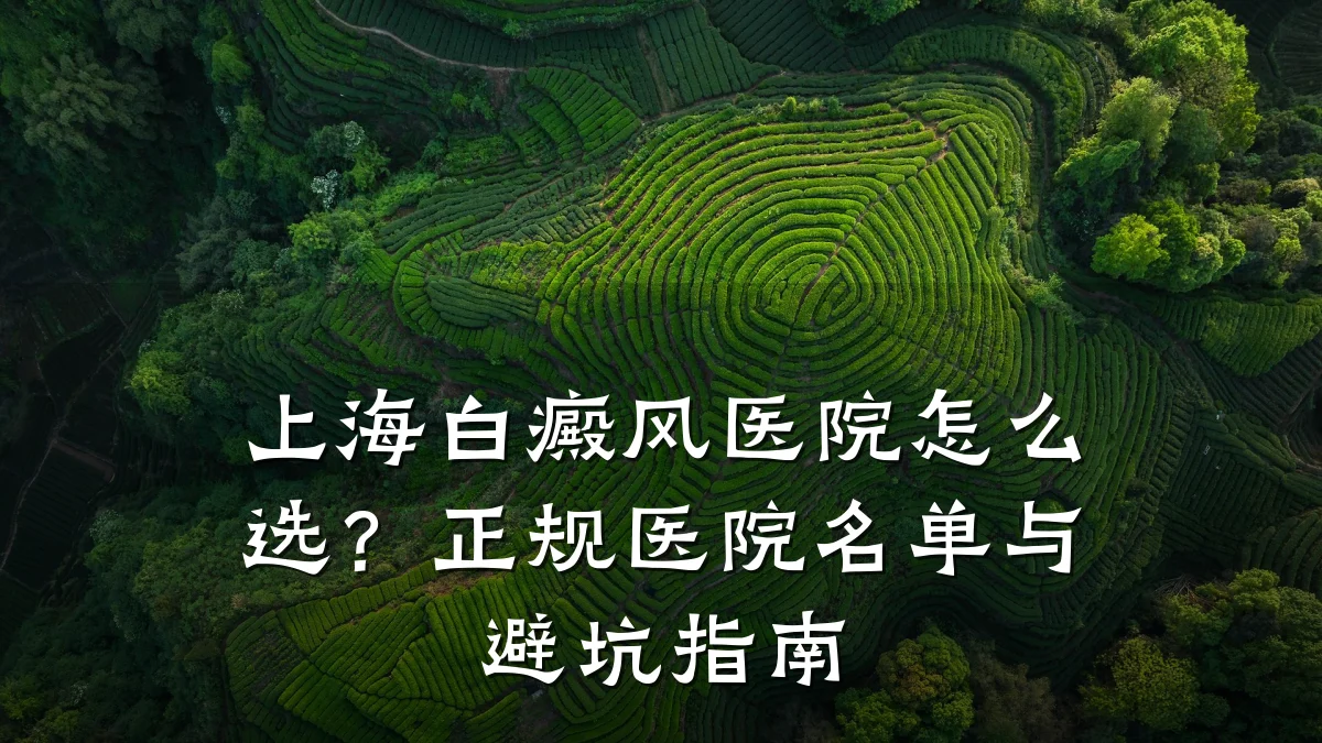 上海白癜风医院怎么选?正规医院名单与避坑指南
