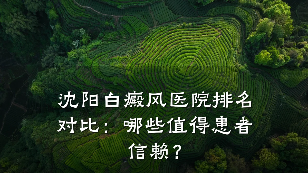 沈阳白癜风医院排名对比:哪些值得患者信赖?