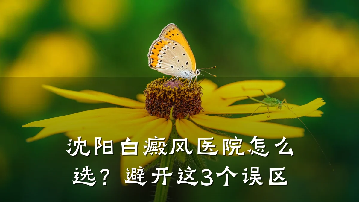 沈阳白癜风医院怎么选?避开这3个误区