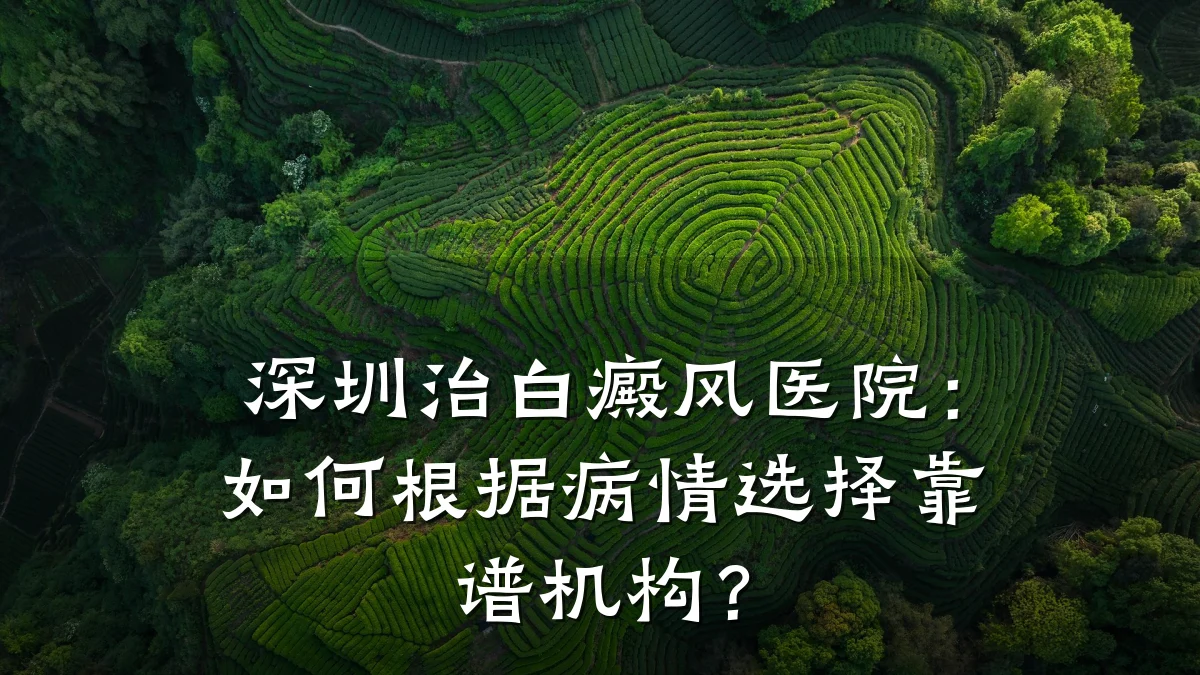 深圳治白癜风医院:如何根据病情选择靠谱机构?