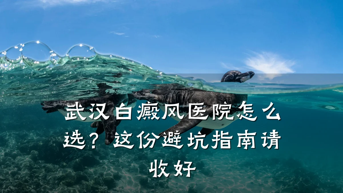 武汉白癜风医院怎么选?这份避坑指南请收好