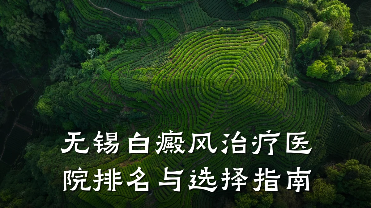 无锡白癜风治疗医院排名与选择指南