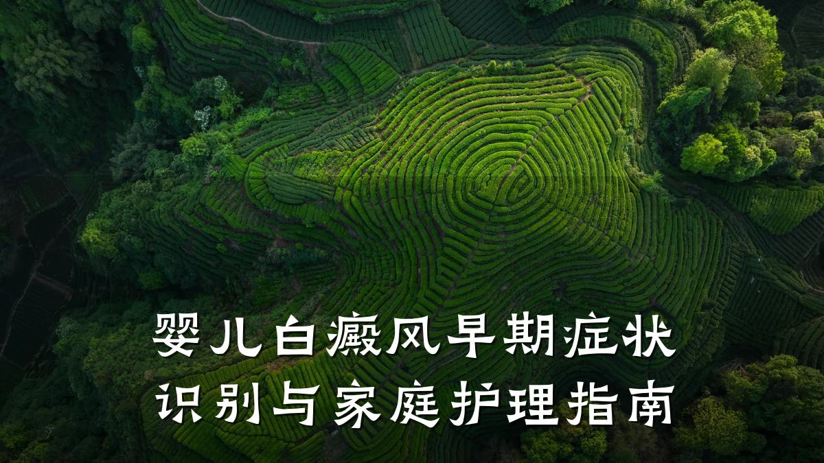 婴儿白癜风早期症状识别与家庭护理指南