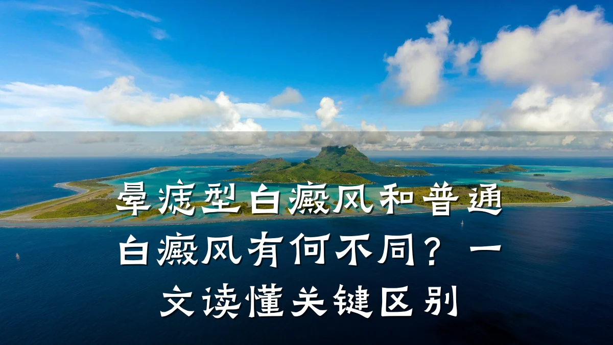 晕痣型白癜风和普通白癜风有何不同？一文读懂关键区别