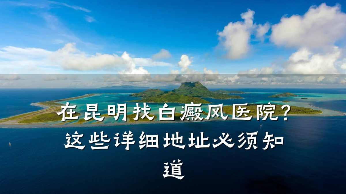 在昆明找白癜风医院?这些详细地址必须知道