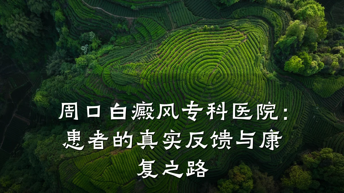周口白癜风专科医院:患者的真实反馈与康复之路