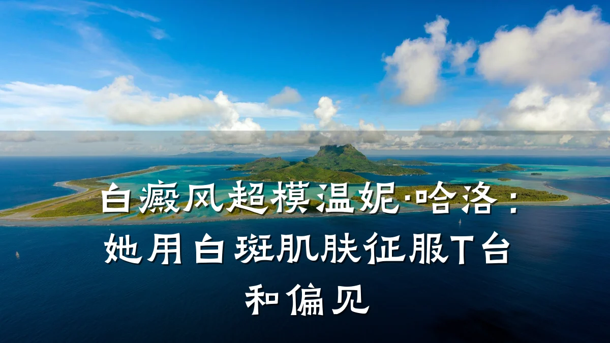 白癜风超模温妮·哈洛:她用白斑肌肤征服T台和偏见