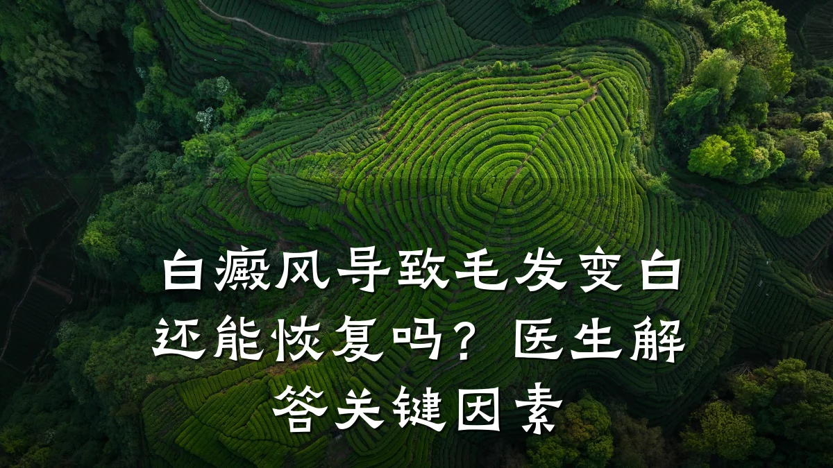 白癜风导致毛发变白还能恢复吗?医生解答关键因素