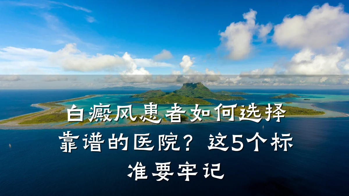白癜风患者如何选择靠谱的医院?这5个标准要牢记