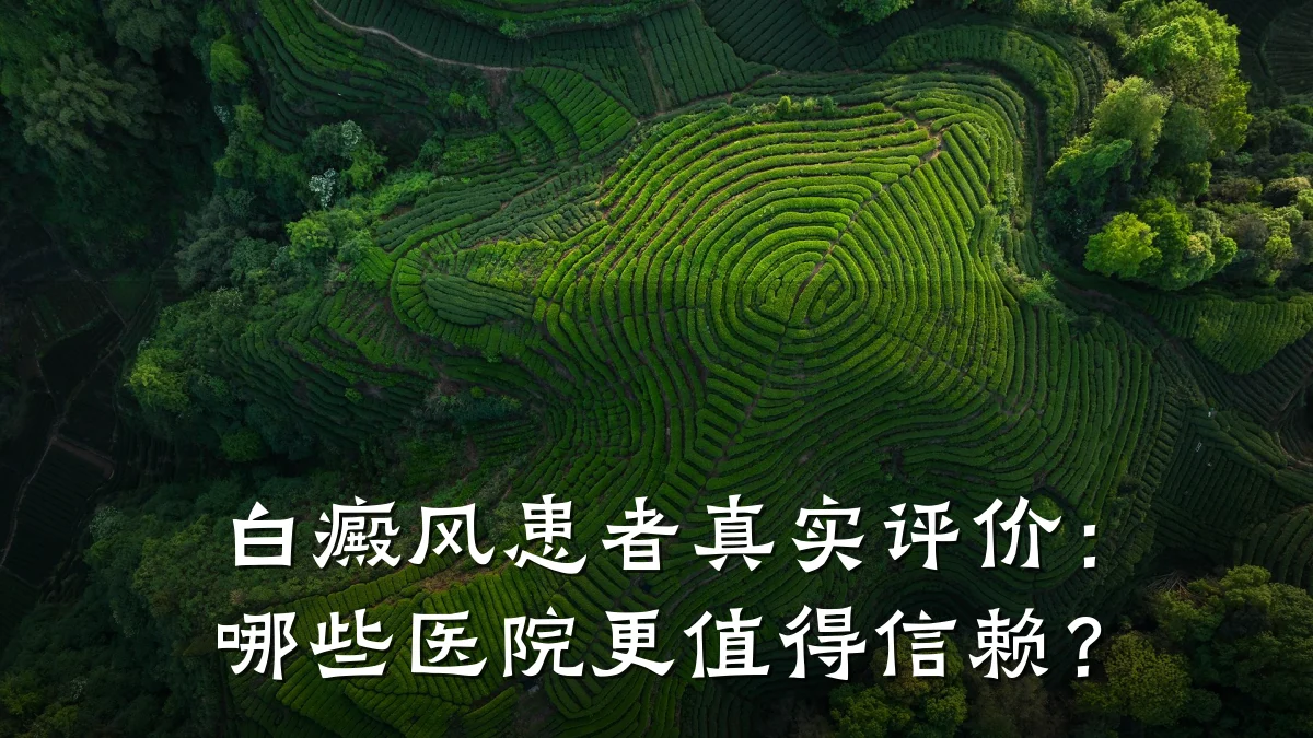 白癜风患者真实评价:哪些医院更值得信赖?