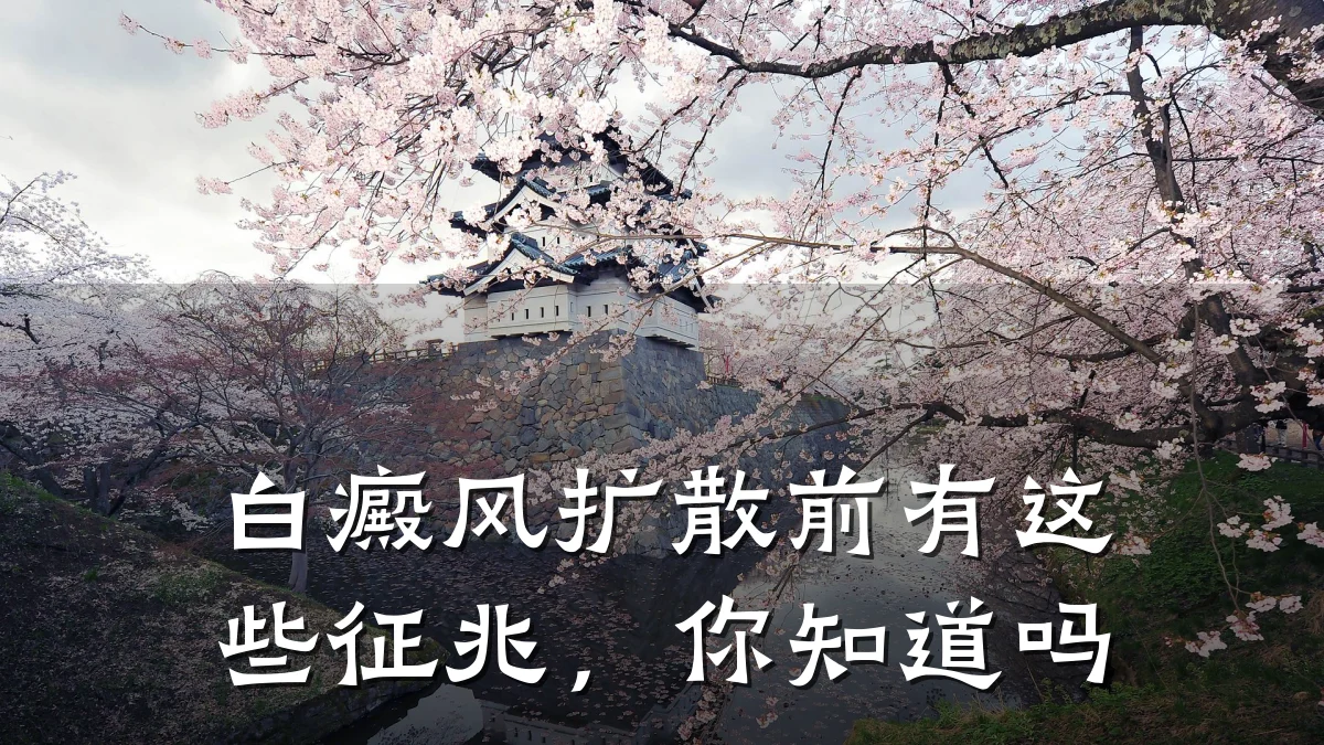 白癜风扩散前有这些征兆,你知道吗