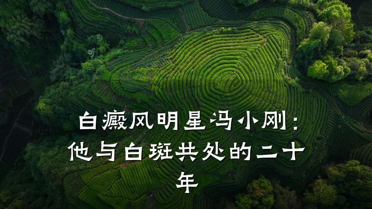白癜风明星冯小刚:他与白斑共处的二十年
