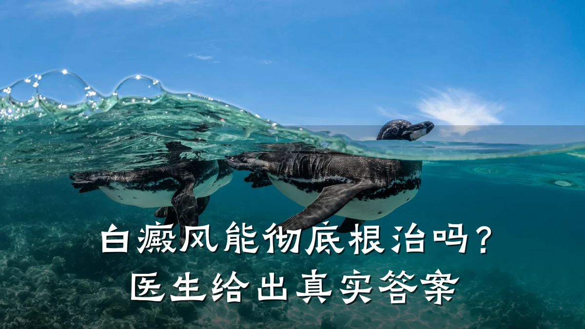 白癜风能彻底根治吗?医生给出真实答案