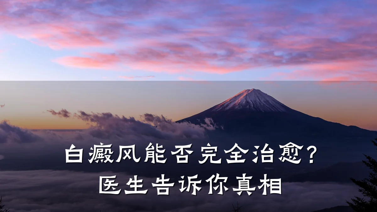 白癜风能否完全治愈?医生告诉你真相