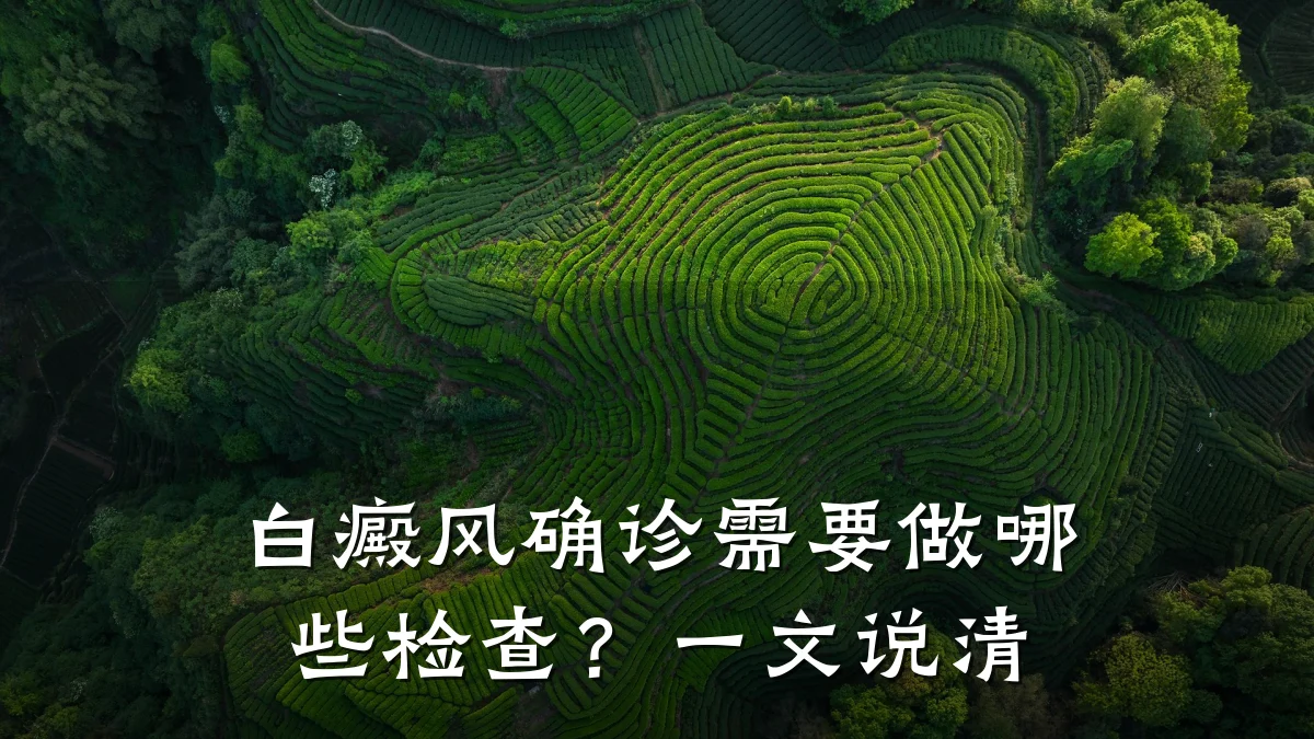 白癜风确诊需要做哪些检查？一文说清