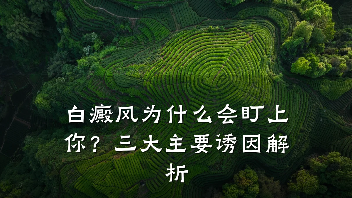 白癜风为什么会盯上你?三大主要诱因解析