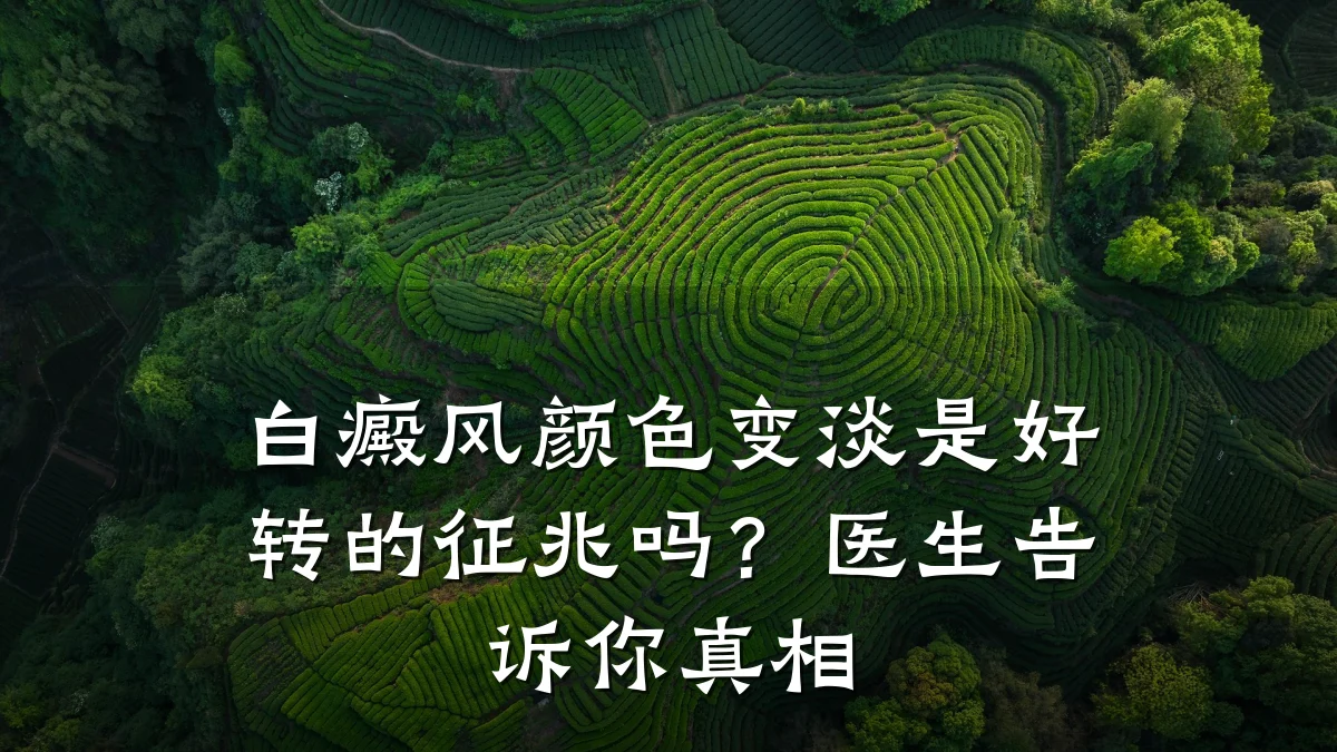 白癜风颜色变淡是好转的征兆吗?医生告诉你真相