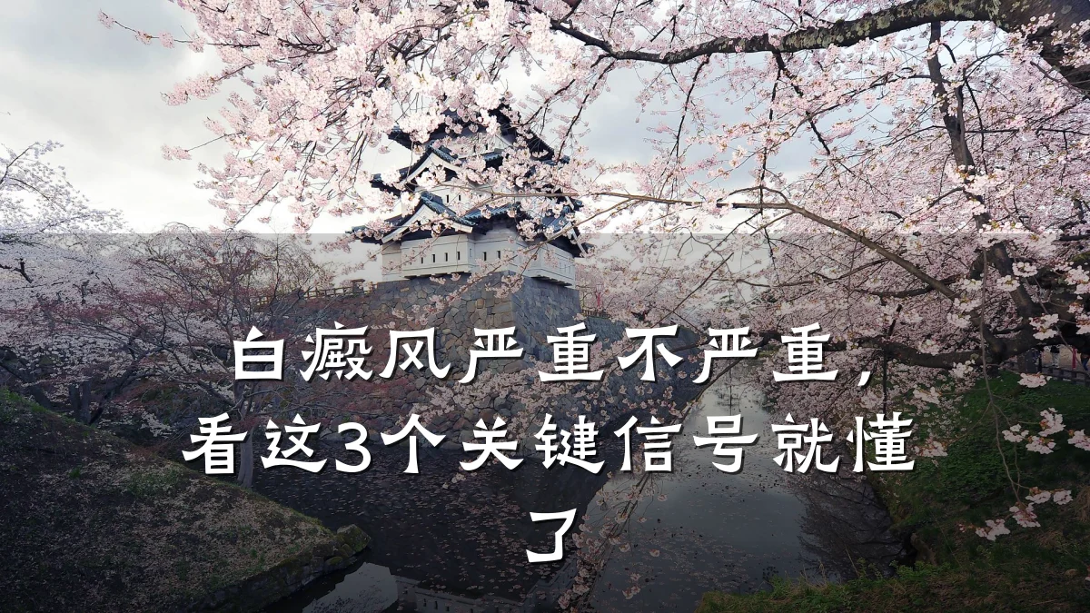 白癜风严重不严重,看这3个关键信号就懂了