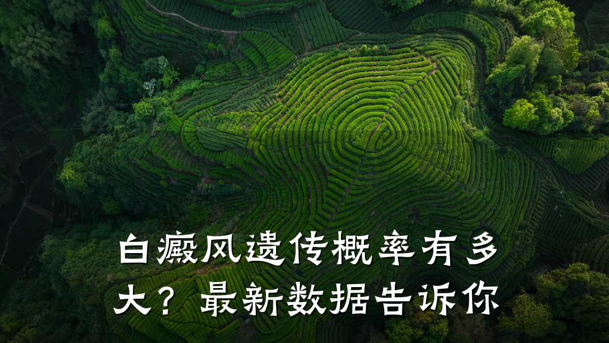 白癜风遗传概率有多大?最新数据告诉你
