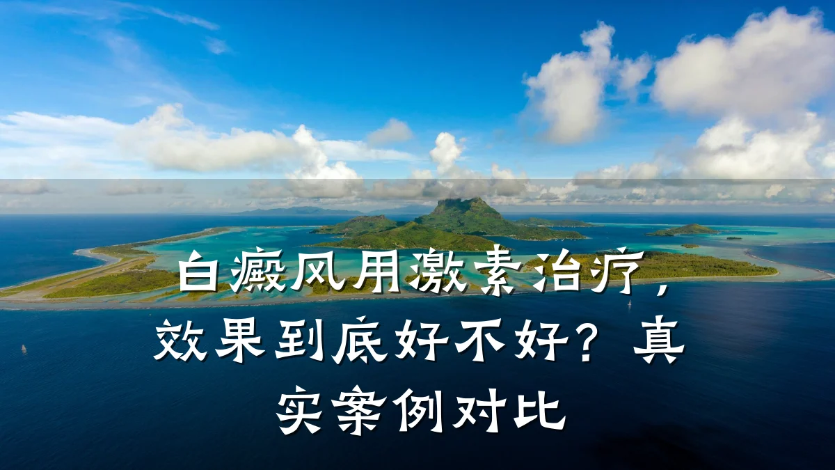 白癜风用激素治疗,效果到底好不好?真实案例对比