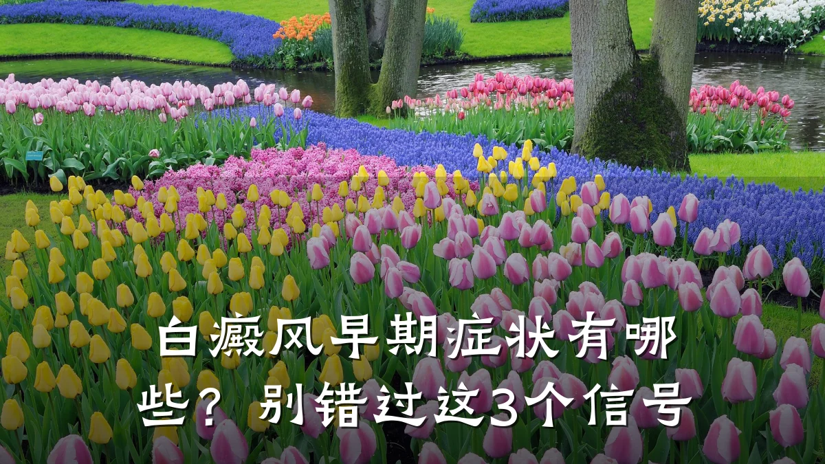 白癜风早期症状有哪些?别错过这3个信号