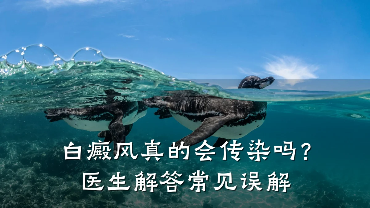 白癜风真的会传染吗?医生解答常见误解